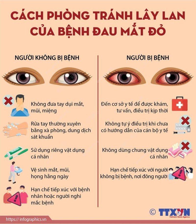 Tổng hợp thông tin về bệnh đau mắt đỏ và cách phòng chống